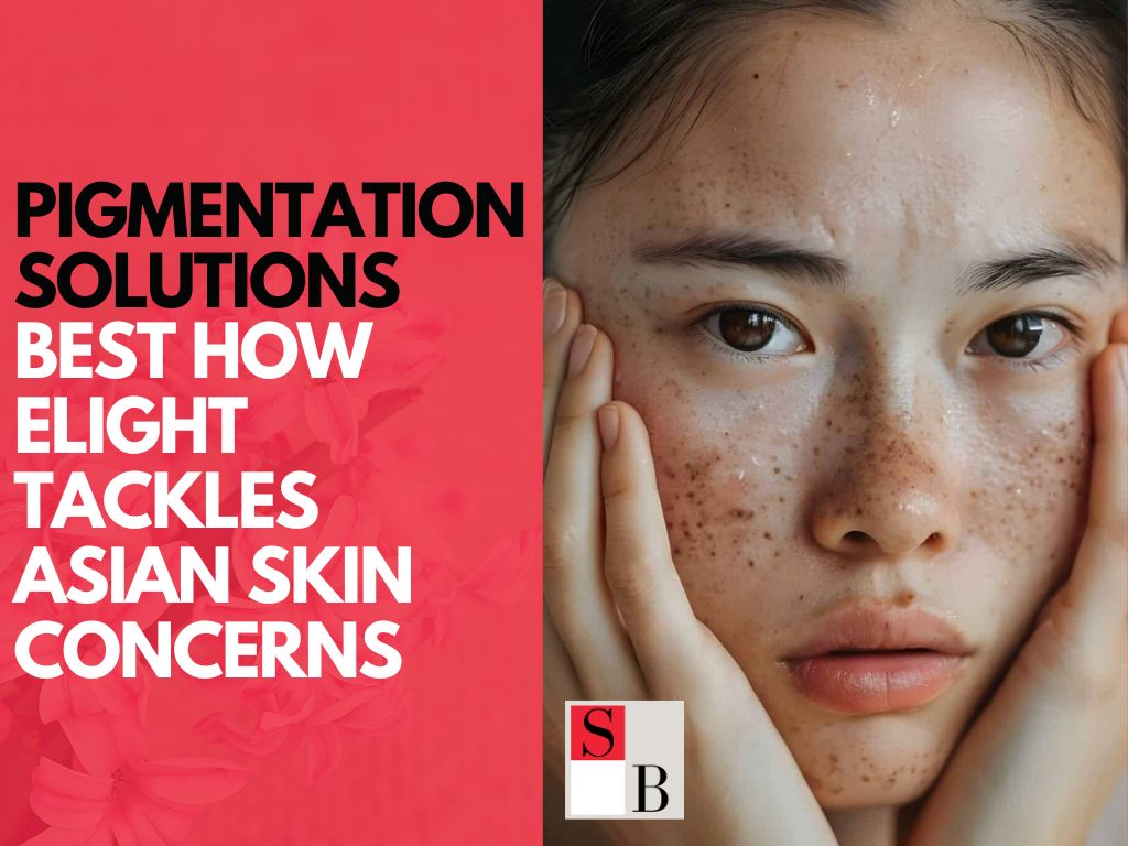 Pigmentation Solutions: How Elight Tackles Asian Skin Concerns