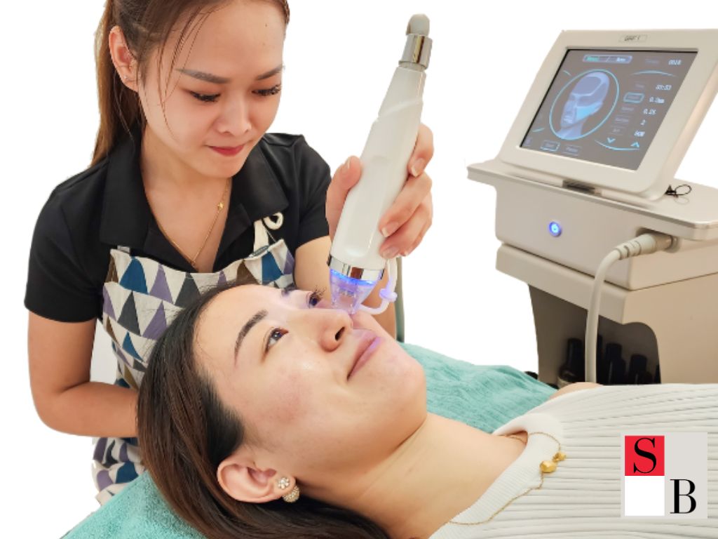 Wellaholic’s RF Microneedling Solutions for Hyperpigmentation in Singapore