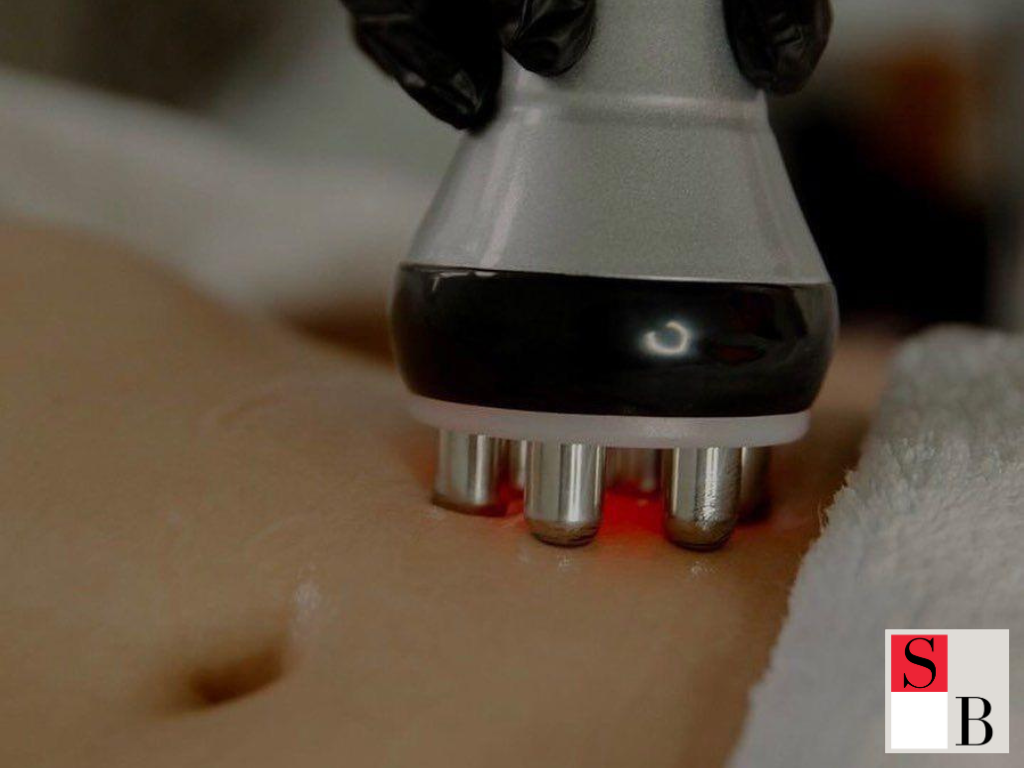 What is RF Sculpting in Singapore