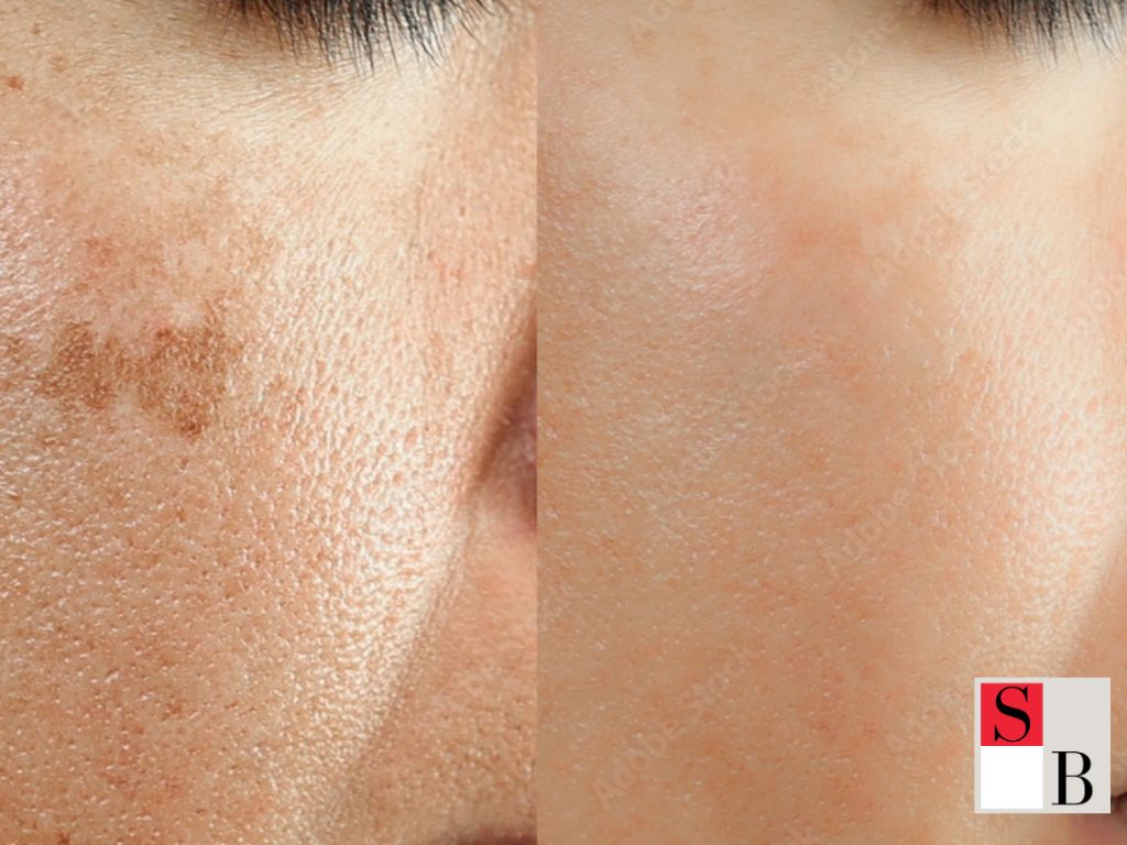 Benefits of Advanced Skincare Solutions in Singapore