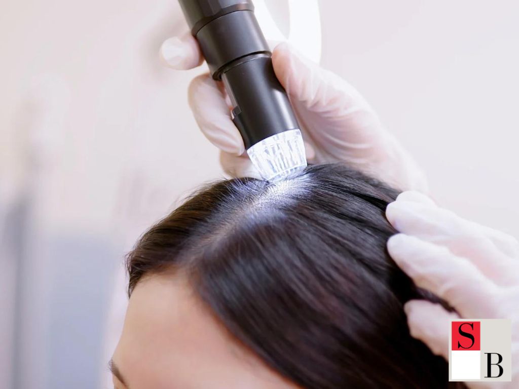 Post-Pregnancy Hair Loss Solutions in Singapore: Understanding the Basics