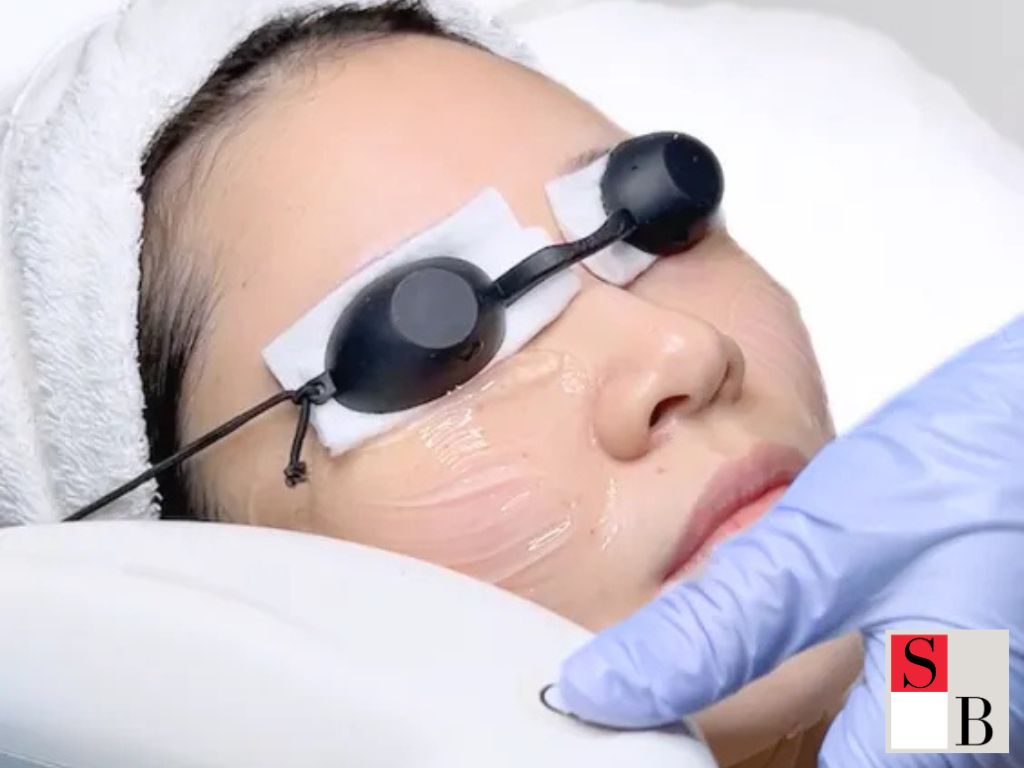 Professional Pigmentation Solutions with Wellaholic’s Elight Facials