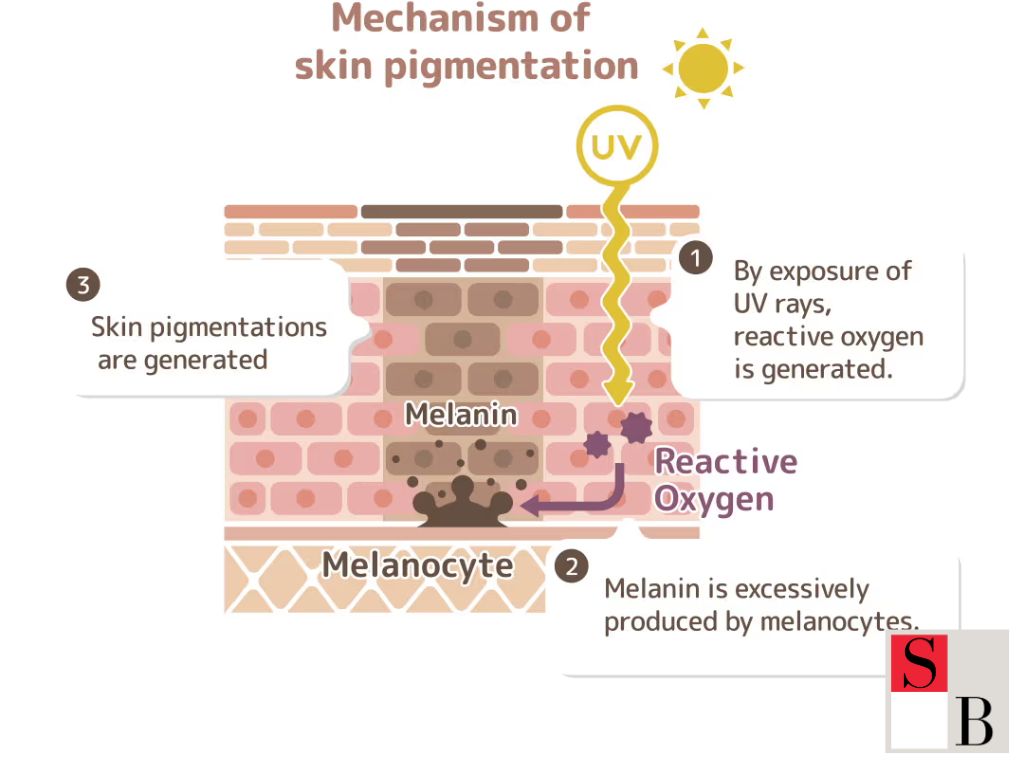 Understanding Pigmentation in Asian Skin