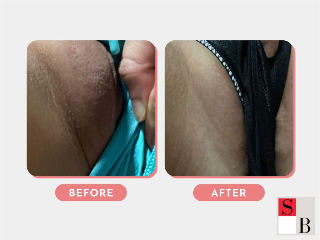 Benefits of Gentle Intimate Care for Sensitive Skin in Singapore’s Pollution