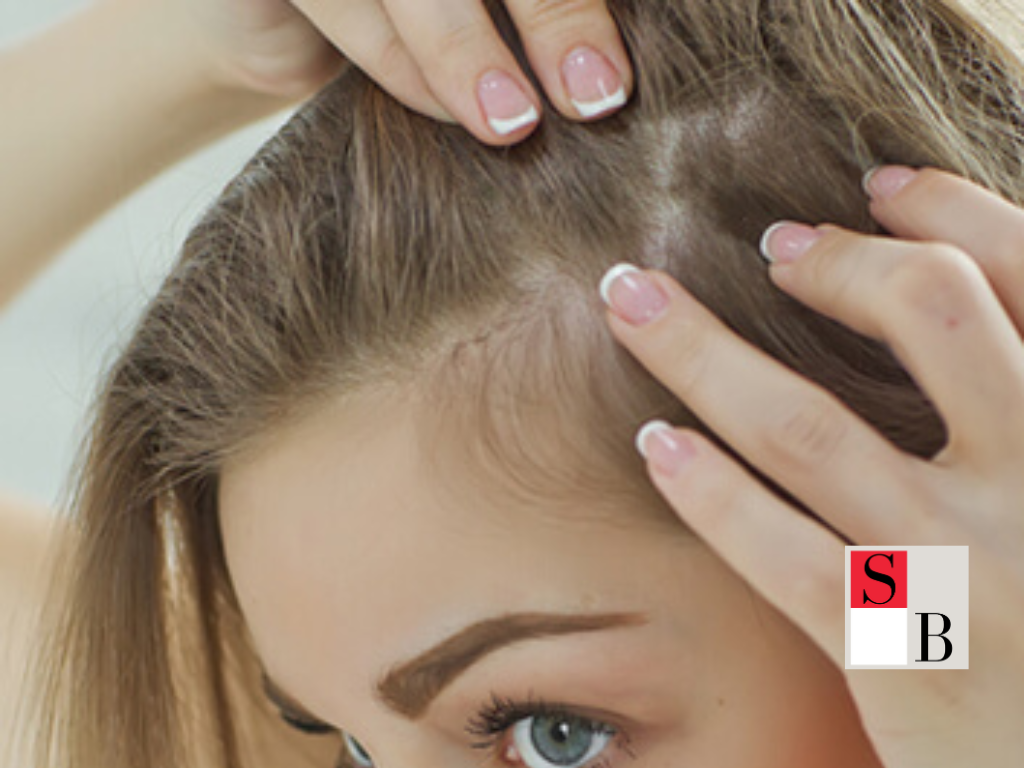 How to Use Hair Growth Supplements Effectively in Singapore