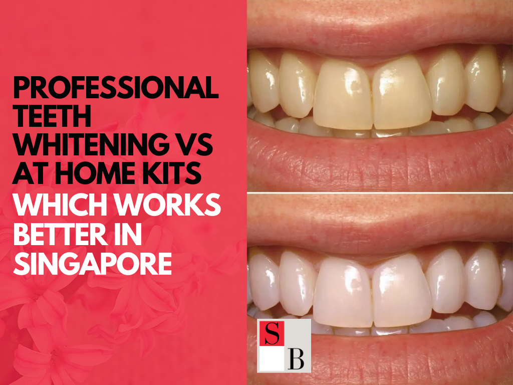Professional Teeth Whitening vs At Home Kits Which Works Better in Singapore