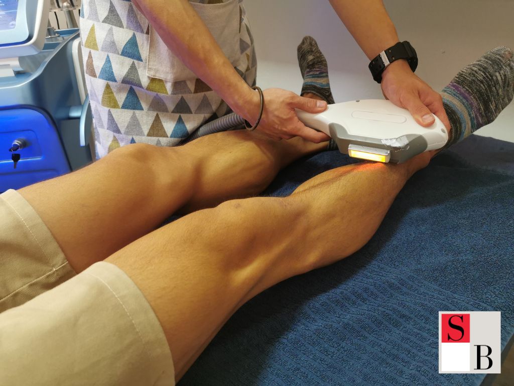 Professional Male Hair Removal Singapore: Wellaholic’s Boyzilian Expertise