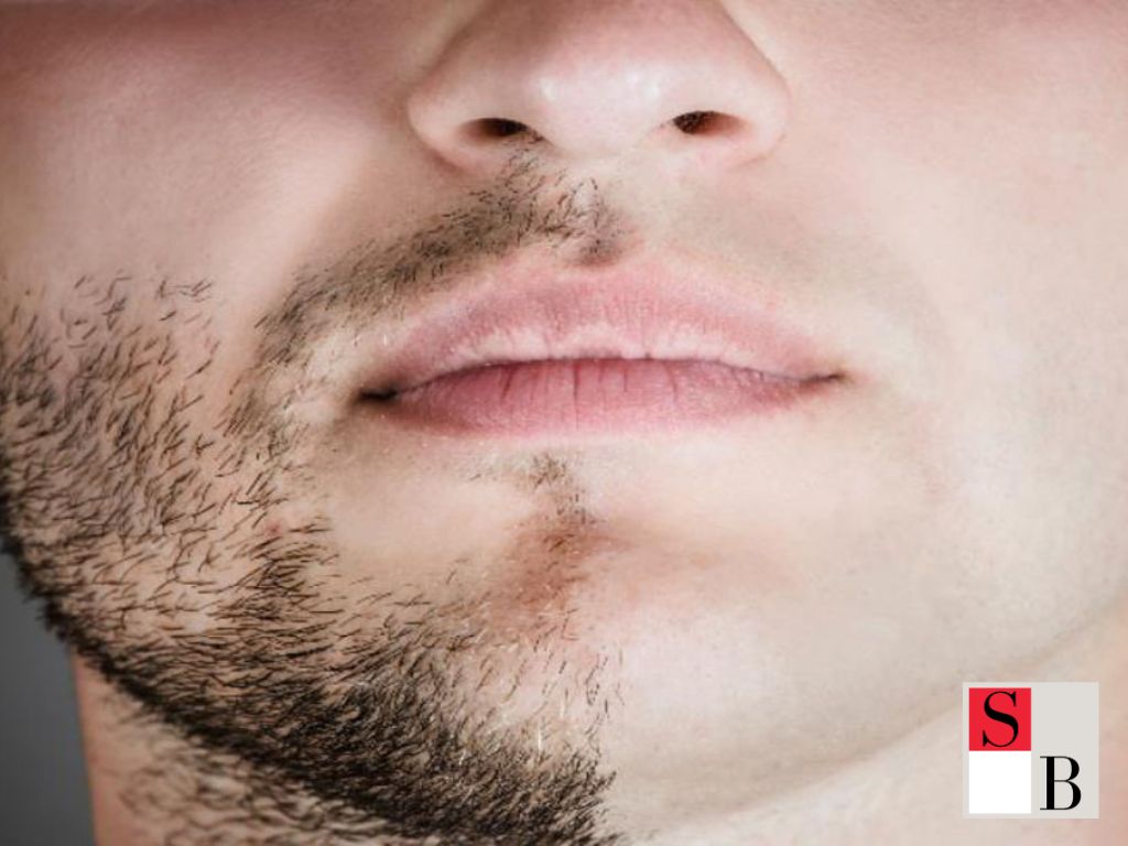 Male Hair Removal Routine in Singapore: Practical Steps for Lasting Results
