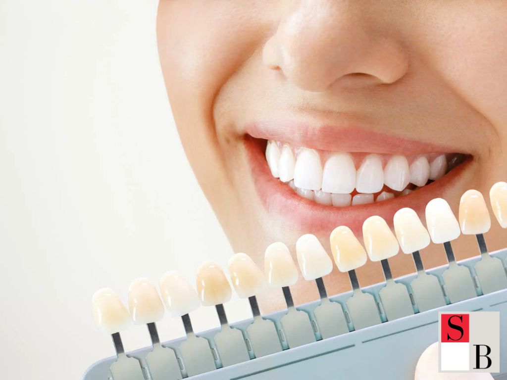 Professional Teeth Whitening Singapore: Advanced Maintenance Solutions with Wellaholic
