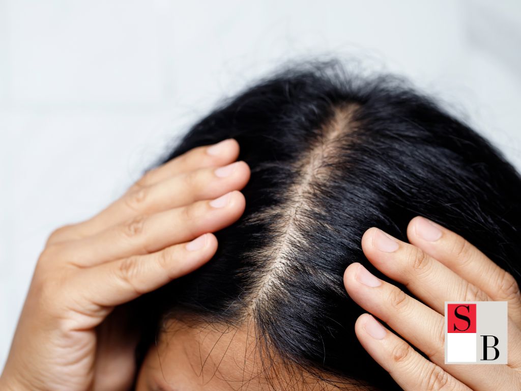 Benefits of Managing Workplace Stress for Hair Health