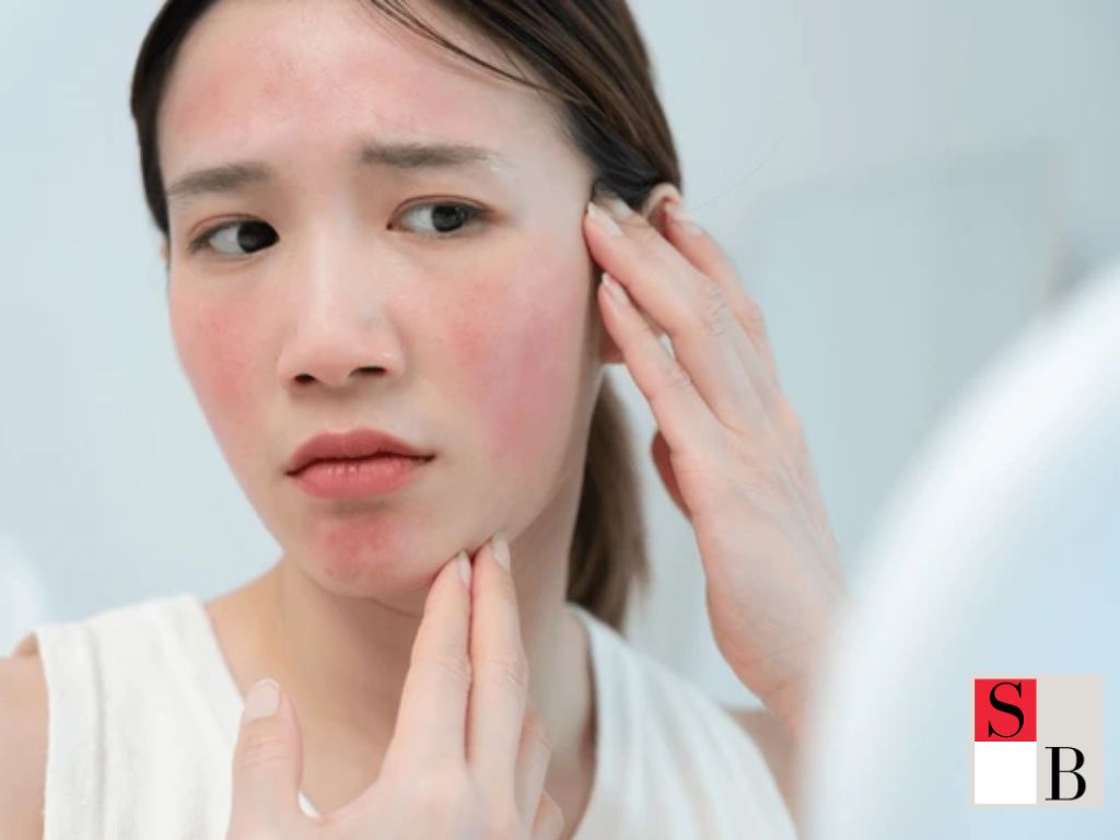 Preparing Your Skin for Special Events