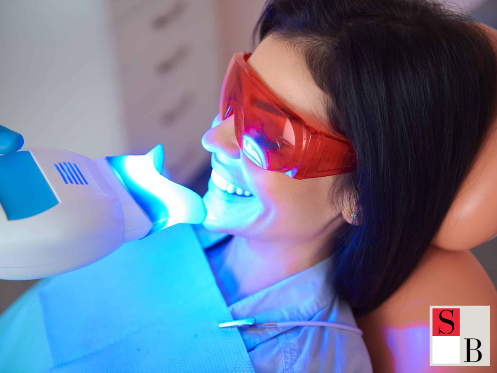 Professional Teeth Whitening vs At Home Kits in Singapore