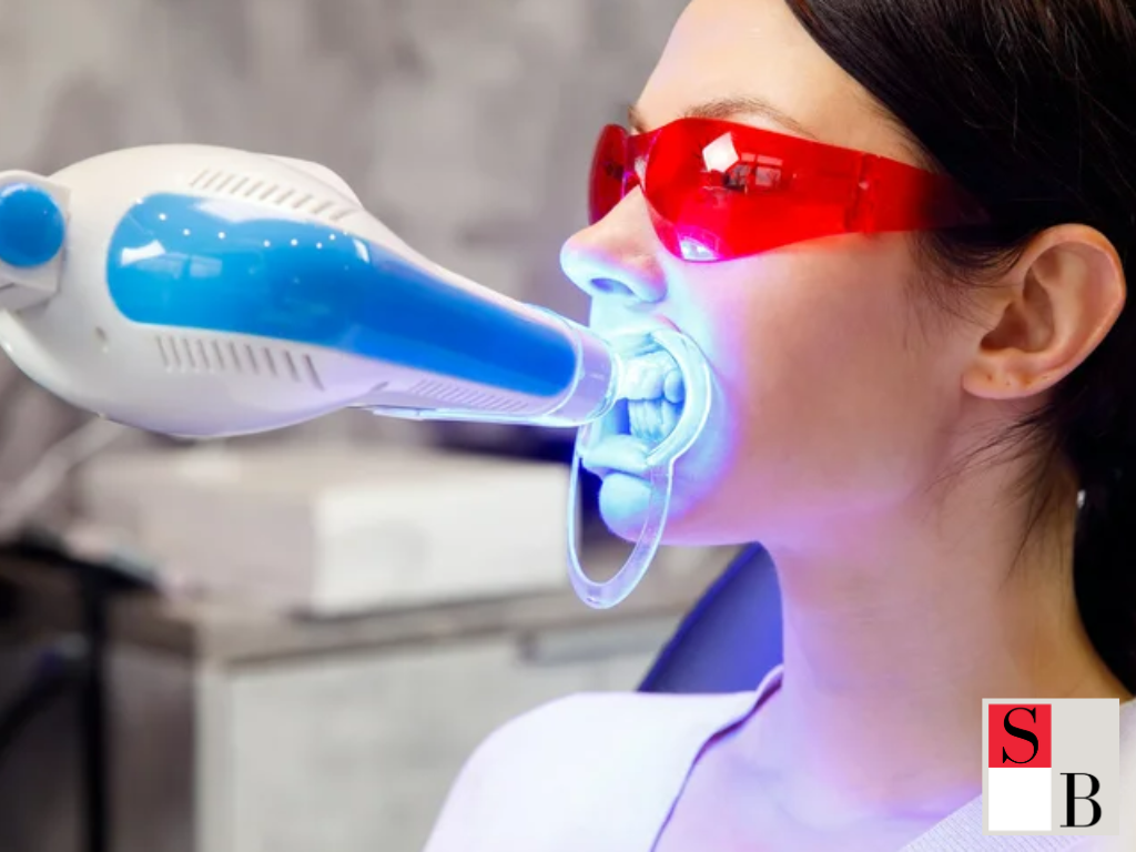 Benefits of Professional Whitening vs At-Home Kits in Singapore