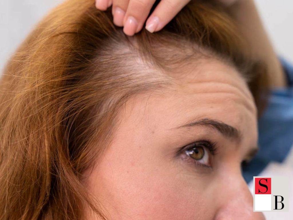 Benefits of Pain-Free Hair Loss Treatment for Busy Singapore Professionals