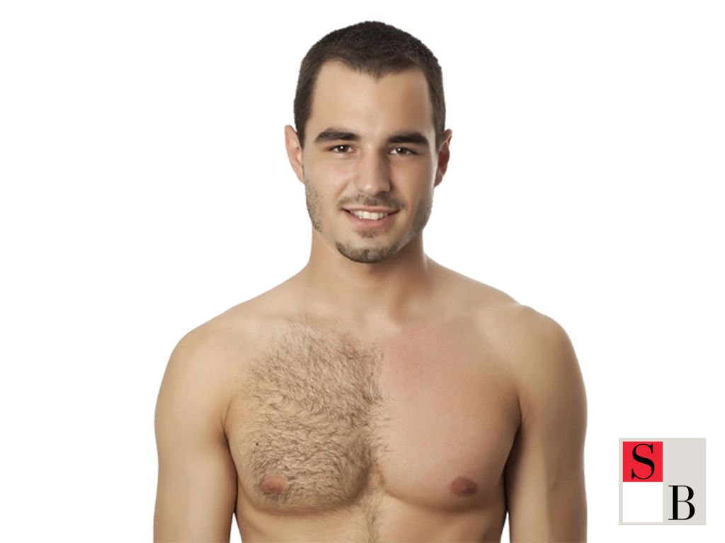 Male Hair Removal in Singapore: The Science Behind Lasting Results