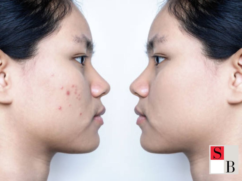 Benefits of Choosing the Right Pillowcase