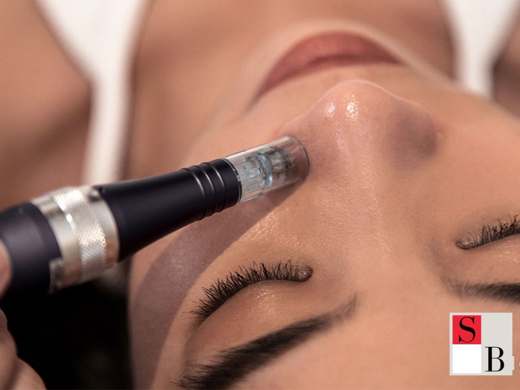 Microneedling Specialists Near Somerset MRT