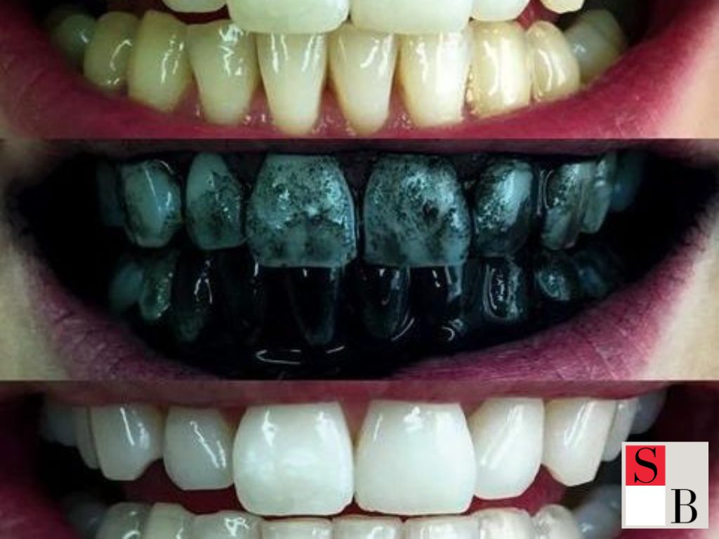 How to Use Activated Charcoal Safely for Teeth Whitening