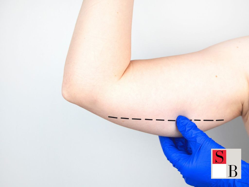 Benefits of Professional Body Contouring in Orchard Road Singapore