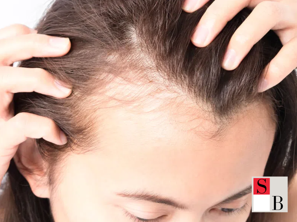 Why Early Action Matters for Teen Hair Loss